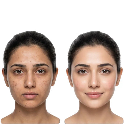 B-Boost Kojic Acid Glow Pads - Clear Skin in 7 Days